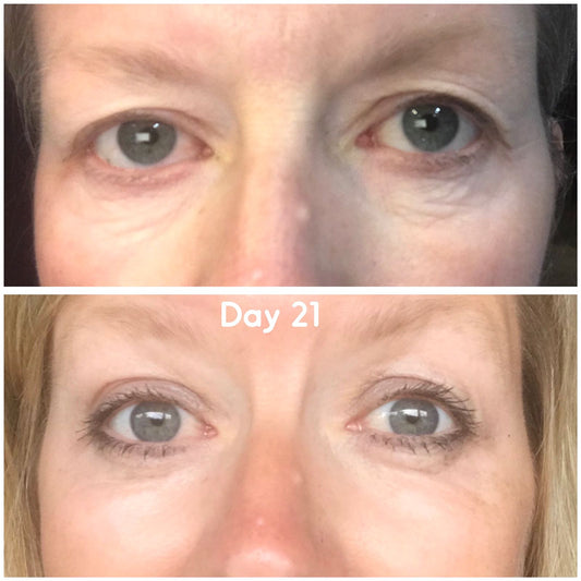 Plasma Care Display Poster Design 1. UK ONLY.