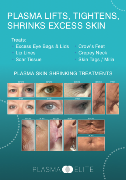 Plasma Care Display Poster Design 1. UK ONLY.