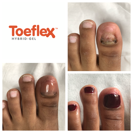 Toeflex Elastic Top Coat
